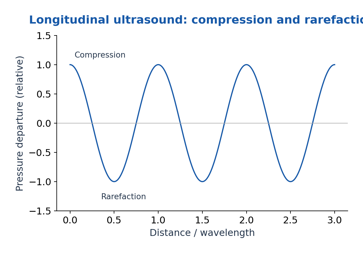 Figure 4.11